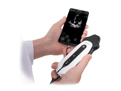 SonoEye foto 2