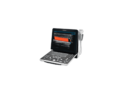 Mindray Z60 foto 2