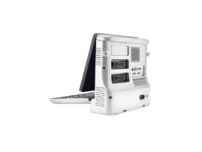 Mindray Z60 foto 3